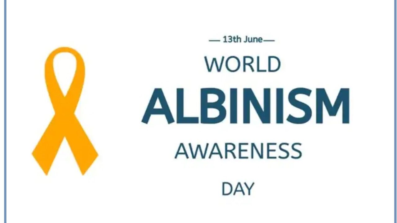 international-albinism-awareness-day